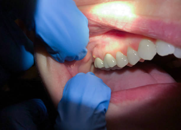 Emergency Dentist for Kids in NY