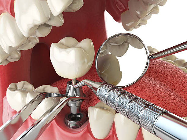 Best Root Canal Emergency Dentist  in Woodbury, NY